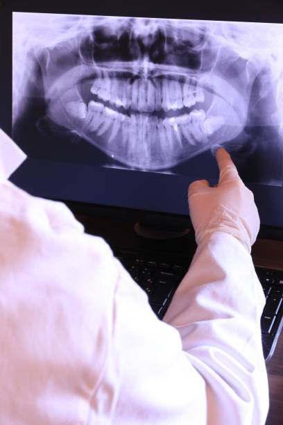 Best Emergency Wisdom Teeth Removal in Sansom Park, TX